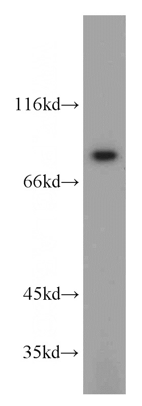 mouse brain tissue were subjected to SDS PAGE followed by western blot with Catalog No:115175(SGSM3 antibody) at dilution of 1:600