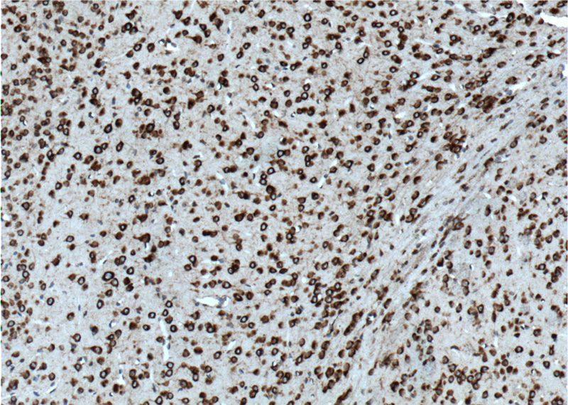 Immunohistochemistry of paraffin-embedded mouse brain tissue slide using Catalog No:107891(ADRA2B-Specific Antibody) at dilution of 1:100 (under 10x lens). heat mediated antigen retrieved with Tris-EDTA buffer(pH9).