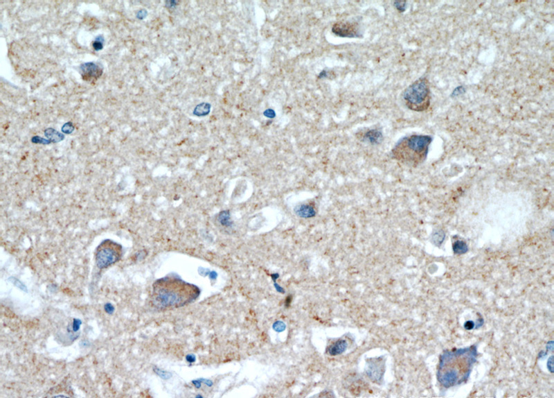 Immunohistochemical of paraffin-embedded human brain using Catalog No:111338(HAPLN4 antibody) at dilution of 1:100 (under 40x lens)