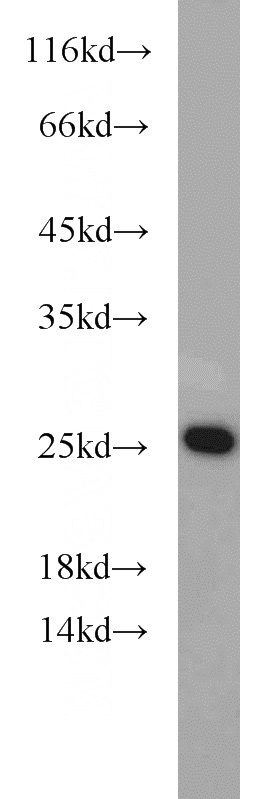 mouse heart tissue were subjected to SDS PAGE followed by western blot with Catalog No:110822(GADD45GIP1 antibody) at dilution of 1:300