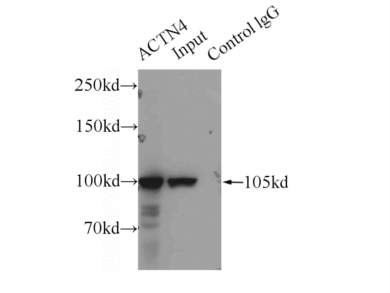 IP Result of anti-ACTN4 (IP:Catalog No:107712, 5ug; Detection:Catalog No:107712 1:1000) with HeLa cells lysate 3000ug.