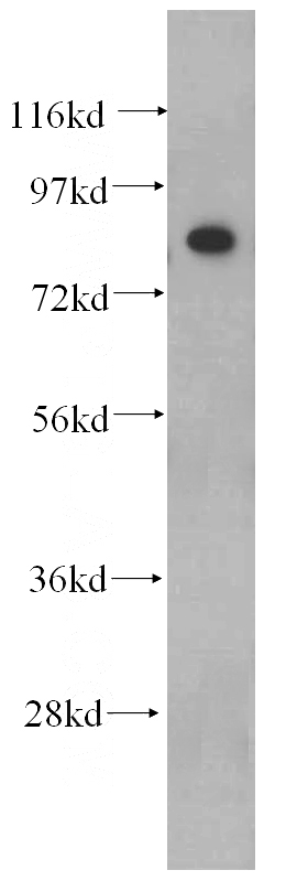BxPC-3 cells were subjected to SDS PAGE followed by western blot with Catalog No:108019(ANAPC5 antibody) at dilution of 1:500
