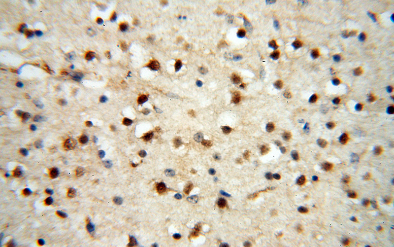 Immunohistochemical of paraffin-embedded human brain using Catalog No:107670(AADACL1 antibody) at dilution of 1:50 (under 40x lens)