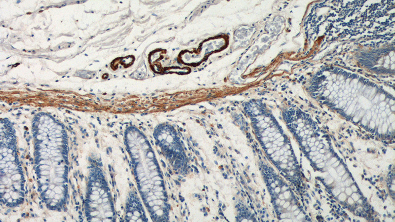 Immunohistochemistry of paraffin-embedded human colon tissue slide using Catalog No:115391(MYH11 Antibody) at dilution of 1:200 (under 10x lens).