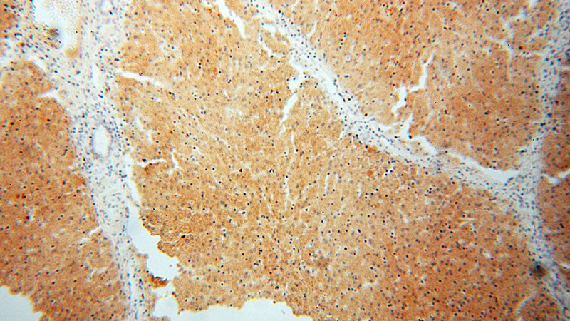 Immunohistochemical of paraffin-embedded human liver using Catalog No:115635(ST8SIA3 antibody) at dilution of 1:50 (under 10x lens)