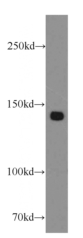 A431 cells were subjected to SDS PAGE followed by western blot with Catalog No:116916(ZBTB40 antibody) at dilution of 1:300