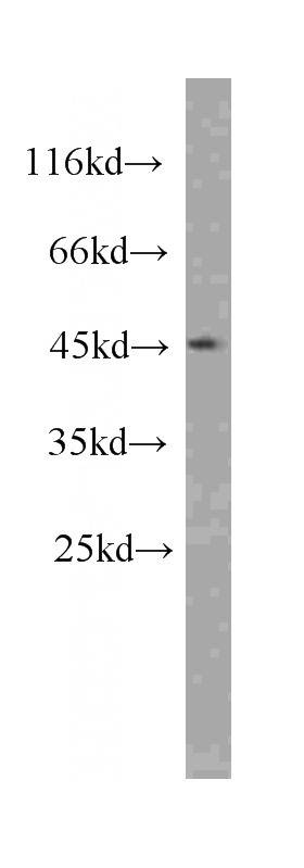 HeLa cells were subjected to SDS PAGE followed by western blot with Catalog No:107126(CD23,FCER2 antibody) at dilution of 1:1000