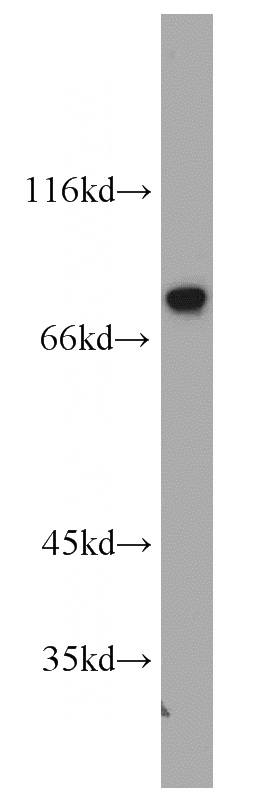 Jurkat cells were subjected to SDS PAGE followed by western blot with Catalog No:113846(PRKCA antibody) at dilution of 1:1000