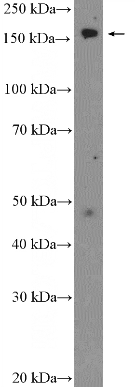 HepG2 cells were subjected to SDS PAGE followed by western blot with Catalog No:109522(CPS1 Antibody) at dilution of 1:1000