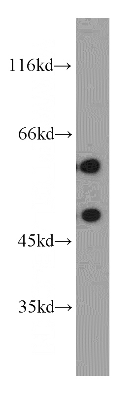 SH-SY5Y cells were subjected to SDS PAGE followed by western blot with Catalog No:110926(GDI1 antibody) at dilution of 1:1000