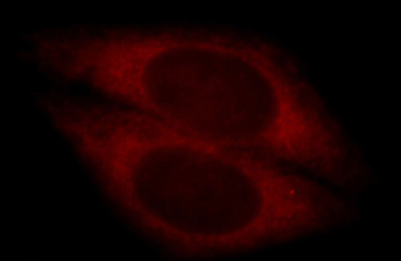 Immunofluorescent analysis of HepG2 cells, using CYP4F11 antibody Catalog No:109706 at 1:25 dilution and Rhodamine-labeled goat anti-rabbit IgG (red).
