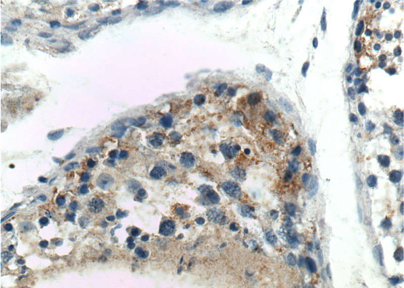 Immunohistochemistry of paraffin-embedded human testis tissue slide using Catalog No:109912(DGKH Antibody) at dilution of 1:200 (under 40x lens).