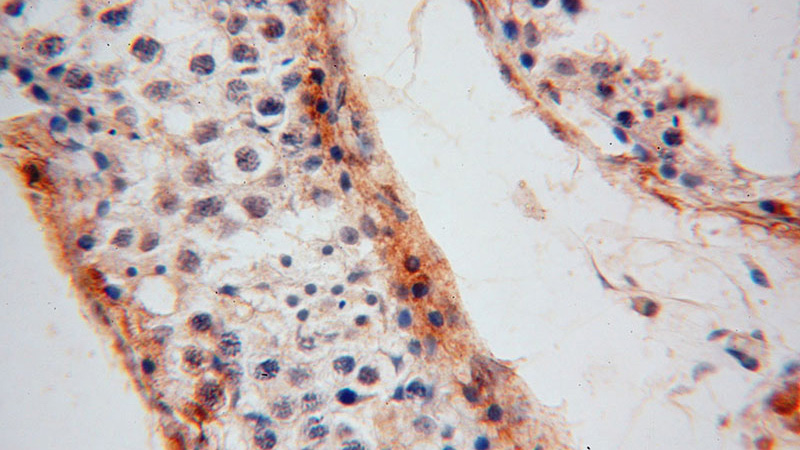 Immunohistochemical of paraffin-embedded human testis using Catalog No:111552(HSD3B2 antibody) at dilution of 1:100 (under 40x lens)