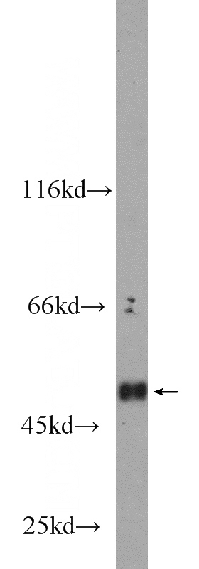 human heart tissue were subjected to SDS PAGE followed by western blot with Catalog No:109348(CLEC14A antibody) at dilution of 1:1000