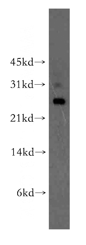 human liver tissue were subjected to SDS PAGE followed by western blot with Catalog No:116665(UBTD2 antibody) at dilution of 1:400