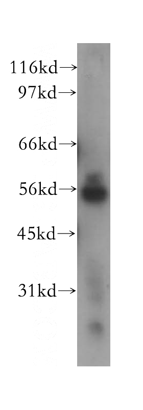 HeLa cells were subjected to SDS PAGE followed by western blot with Catalog No:113101(NEK11 antibody) at dilution of 1:400