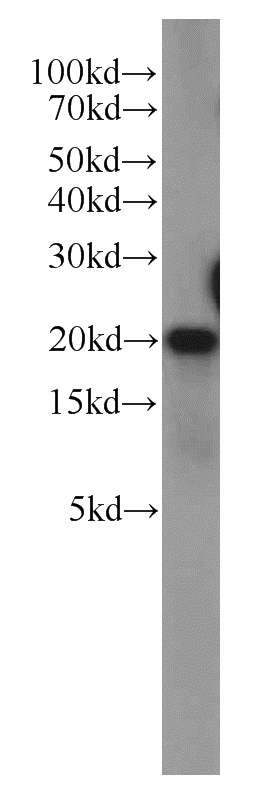 HeLa cells were subjected to SDS PAGE followed by western blot with Catalog No:114062(POP7 antibody) at dilution of 1:600