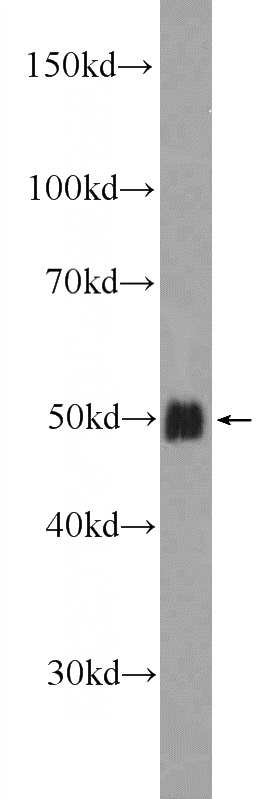 COLO 320 cells were subjected to SDS PAGE followed by western blot with Catalog No:115519(SOX7 Antibody) at dilution of 1:600