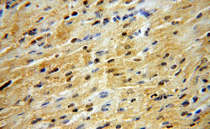 Immunohistochemical of paraffin-embedded human heart using Catalog No:109968(DNMT3A antibody) at dilution of 1:50 (under 40x lens)