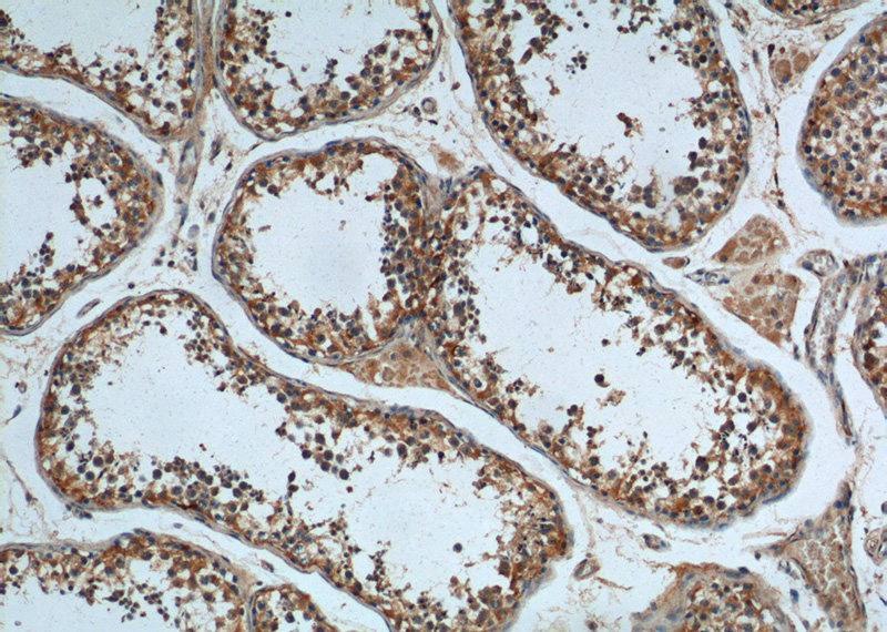 Immunohistochemistry of paraffin-embedded human testis tissue slide using Catalog No:116237(TRAIP Antibody) at dilution of 1:200 (under 10x lens).