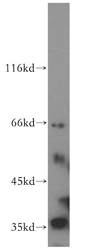 mouse liver tissue were subjected to SDS PAGE followed by western blot with Catalog No:115597(SRPR antibody) at dilution of 1:500