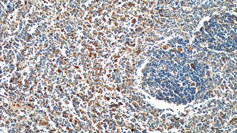 Immunohistochemistry of paraffin-embedded human spleen tissue slide using Catalog No:110626(FFAR2 Antibody) at dilution of 1:100 (under 10x lens).