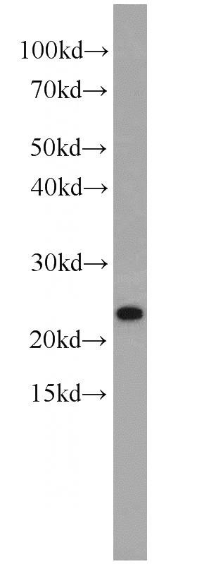 HepG2 cells were subjected to SDS PAGE followed by western blot with Catalog No:113745(PCNP antibody) at dilution of 1:600