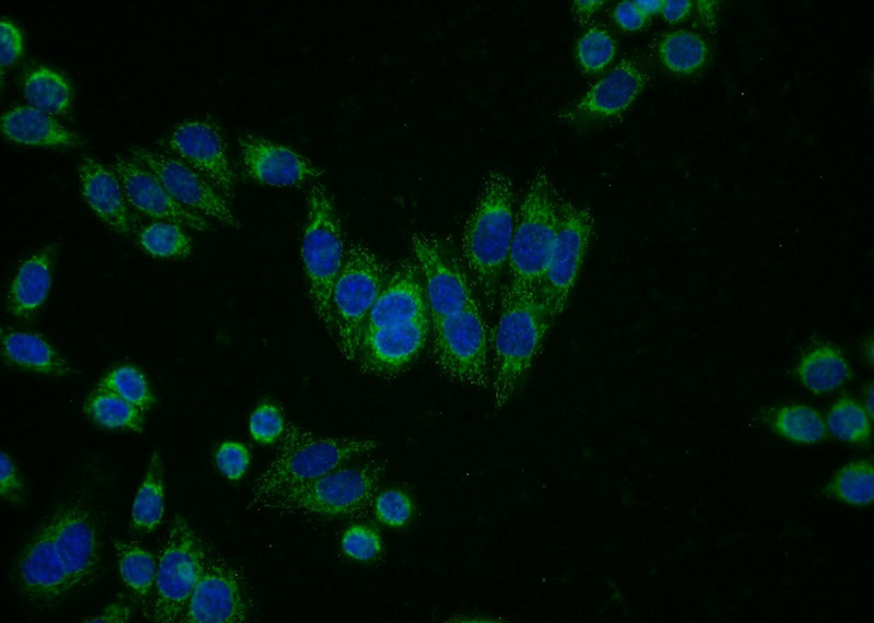 Immunofluorescent analysis of HeLa cells using Catalog No:113015(NAGA Antibody) at dilution of 1:50 and Alexa Fluor 488-congugated AffiniPure Goat Anti-Rabbit IgG(H+L)