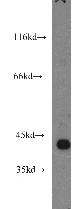 HEK-293 cells were subjected to SDS PAGE followed by western blot with Catalog No:108256(ARG2 antibody) at dilution of 1:1000