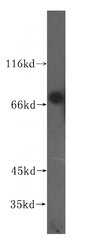 human testis tissue were subjected to SDS PAGE followed by western blot with Catalog No:116030(TGM4 antibody) at dilution of 1:300