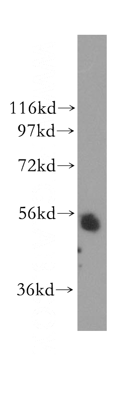 mouse testis tissue were subjected to SDS PAGE followed by western blot with Catalog No:115975(TADA2L antibody) at dilution of 1:400