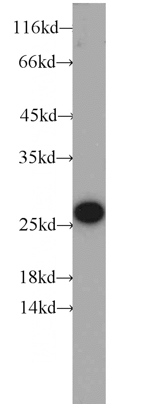 mouse brain tissue were subjected to SDS PAGE followed by western blot with Catalog No:114570(RCAN1 antibody) at dilution of 1:500