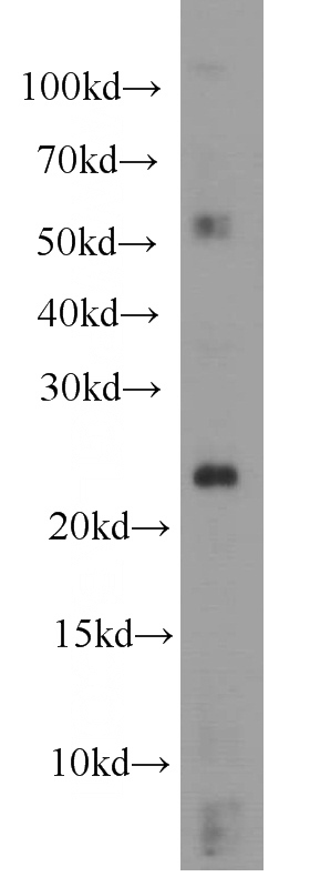 HeLa cells were subjected to SDS PAGE followed by western blot with Catalog No:114660(RHoc antibody) at dilution of 1:500