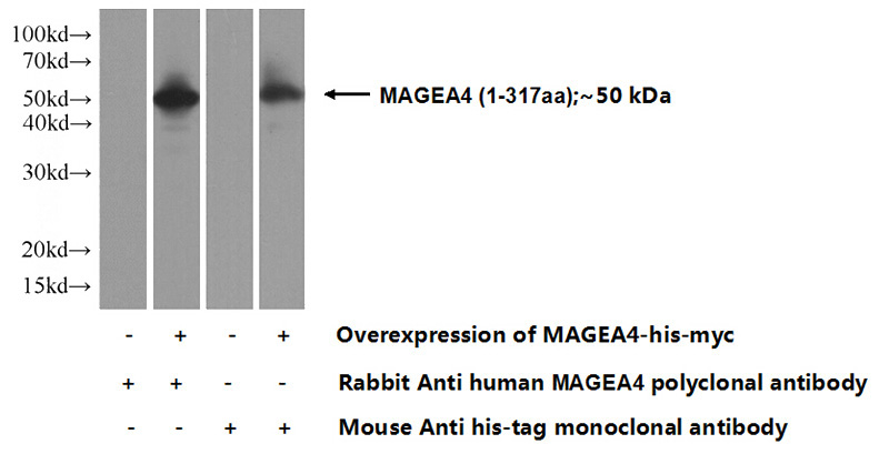 Transfected HEK-293 cells were subjected to SDS PAGE followed by western blot with Catalog No:112381(MAGEA4 Antibody) at dilution of 1:500
