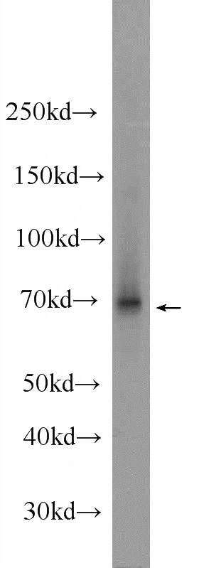 HEK-293 cells were subjected to SDS PAGE followed by western blot with Catalog No:115980(TAF15 Antibody) at dilution of 1:1000