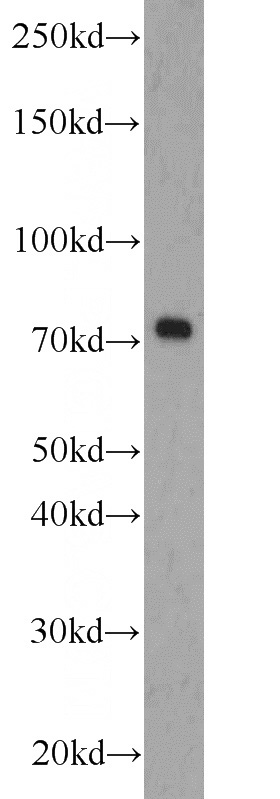 L02 cells were subjected to SDS PAGE followed by western blot with Catalog No:116910(ZBTB20 antibody) at dilution of 1:1000