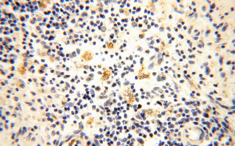 Immunohistochemical of paraffin-embedded human spleen using Catalog No:109057(CD40LG antibody) at dilution of 1:100 (under 40x lens)
