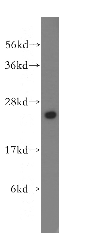 human pancreas tissue were subjected to SDS PAGE followed by western blot with Catalog No:116569(CMPK1 antibody) at dilution of 1:300