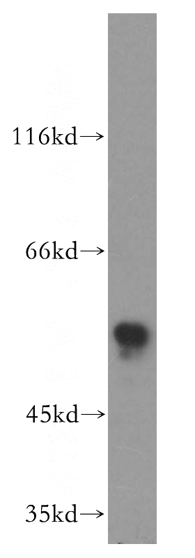 HeLa cells were subjected to SDS PAGE followed by western blot with Catalog No:114519(RAD9A antibody) at dilution of 1:500