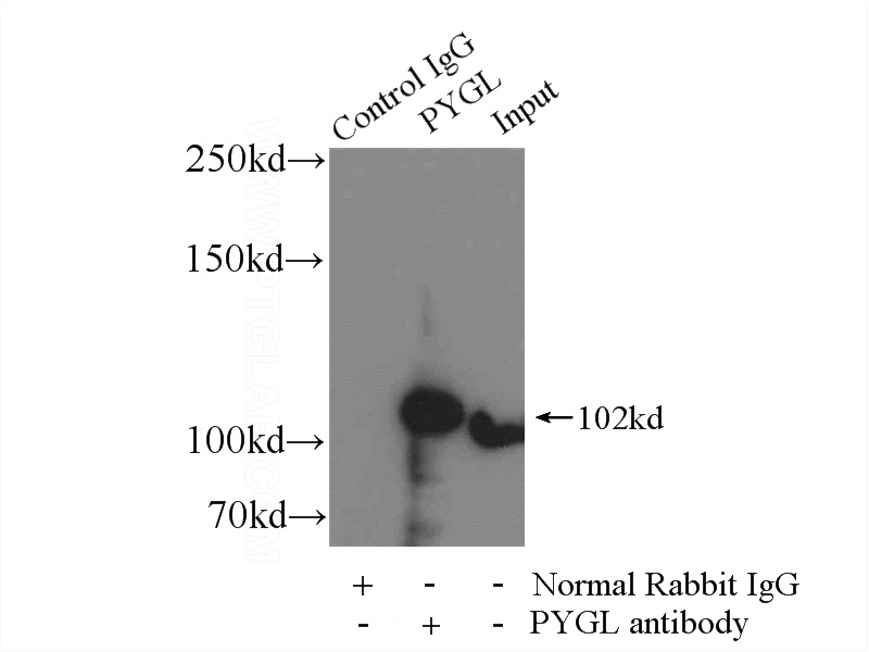 IP Result of anti-PYGL (IP:Catalog No:114359, 4ug; Detection:Catalog No:114359 1:1000) with mouse liver tissue lysate 4000ug.