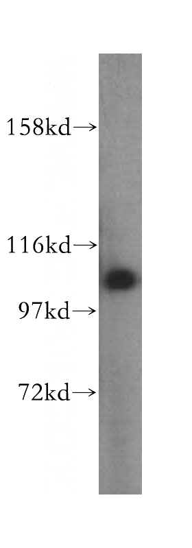 HepG2 cells were subjected to SDS PAGE followed by western blot with Catalog No:107953(AARS antibody) at dilution of 1:400