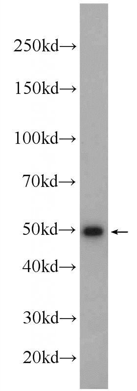 Raji cells were subjected to SDS PAGE followed by western blot with Catalog No:111831(IRF1 Antibody) at dilution of 1:300