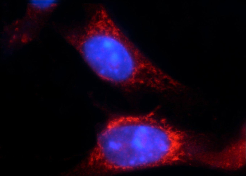 Immunofluorescent analysis of NIH/3T3 cells using Catalog No:116231(TRAF3IP1 Antibody) at dilution of 1:25 and Rhodamine-Goat anti-Rabbit IgG