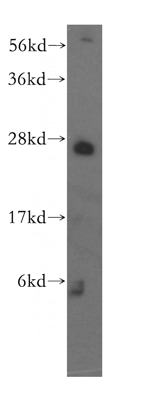 Jurkat cells were subjected to SDS PAGE followed by western blot with Catalog No:110411(EXOSC4 antibody) at dilution of 1:500