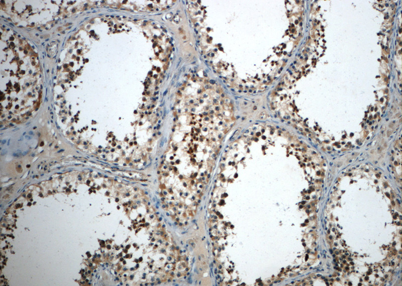 Immunohistochemistry of paraffin-embedded human testis slide using Catalog No:108959(CCDC104 Antibody) at dilution of 1:50