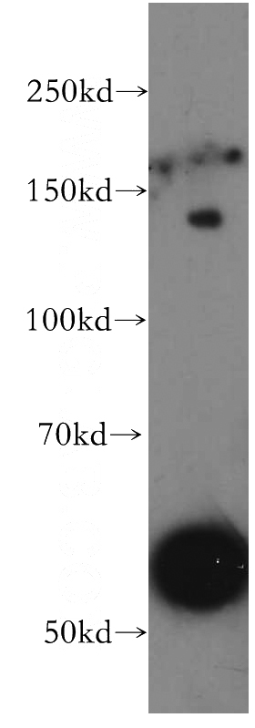 mouse liver tissue were subjected to SDS PAGE followed by western blot with Catalog No:116654(UBN1-Specific antibody) at dilution of 1:500