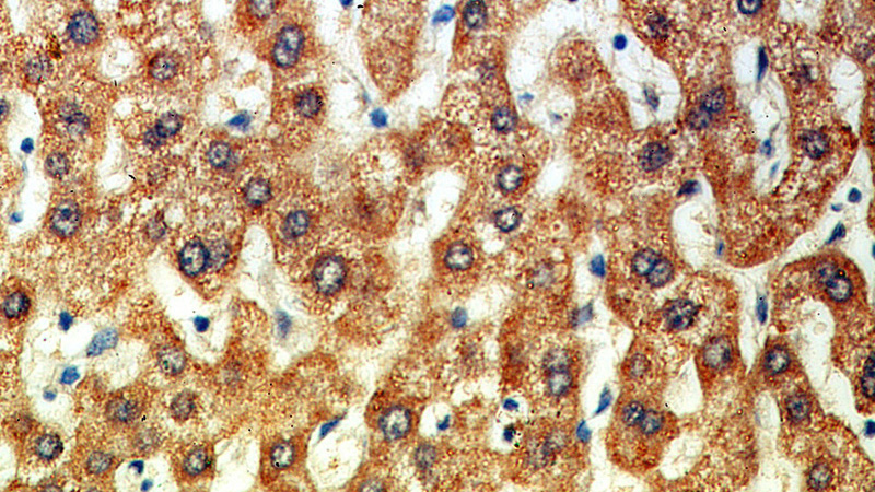 Immunohistochemical of paraffin-embedded human liver using Catalog No:107966(ALDH2 antibody) at dilution of 1:100 (under 40x lens)
