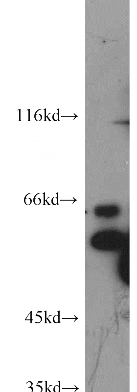 HeLa cells were subjected to SDS PAGE followed by western blot with Catalog No:108283(ATF2 antibody) at dilution of 1:500