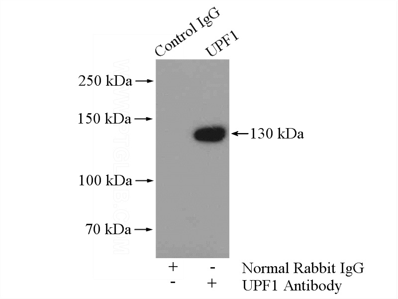 IP Result of anti-UPF1 (IP:Catalog No:116625, 4ug; Detection:Catalog No:116625 1:500) with Raji cells lysate 2000ug.