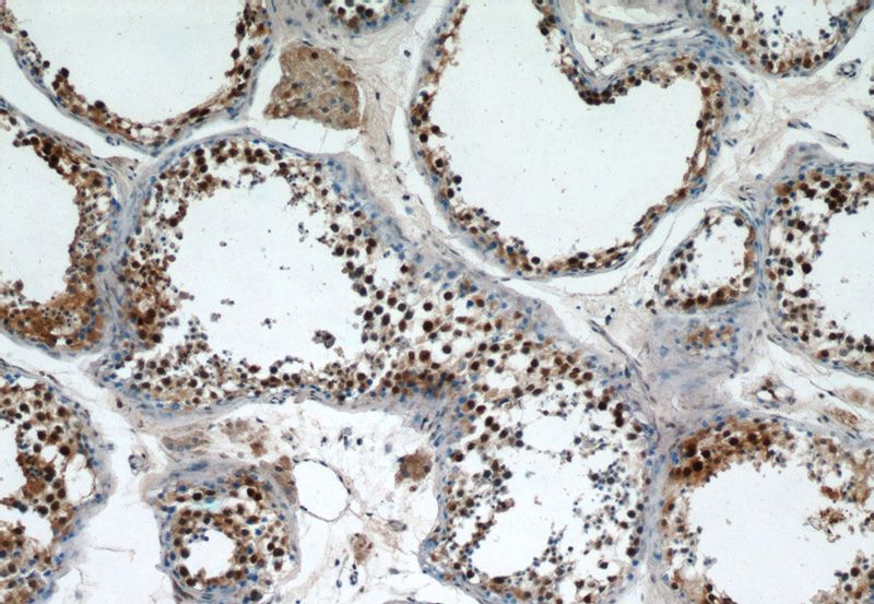 Immunohistochemistry of paraffin-embedded human testis tissue slide using Catalog No:114230(PRPF39 Antibody) at dilution of 1:100 (under 10x lens)